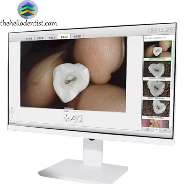Touch Screen Endoscope System - Image 4